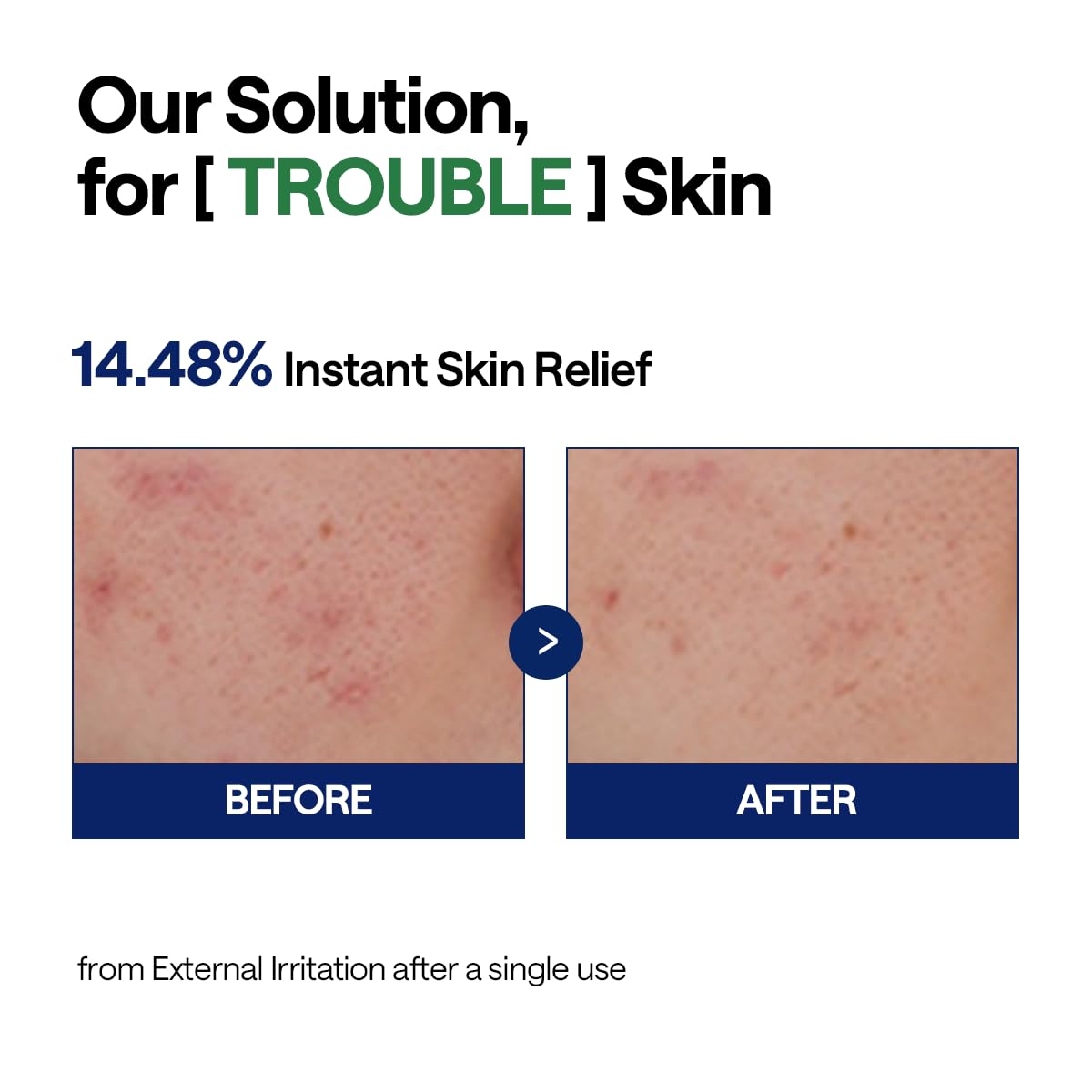 Mediheal Repair Serum