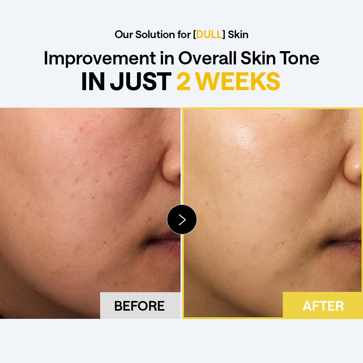 Mediheal Toner Pads