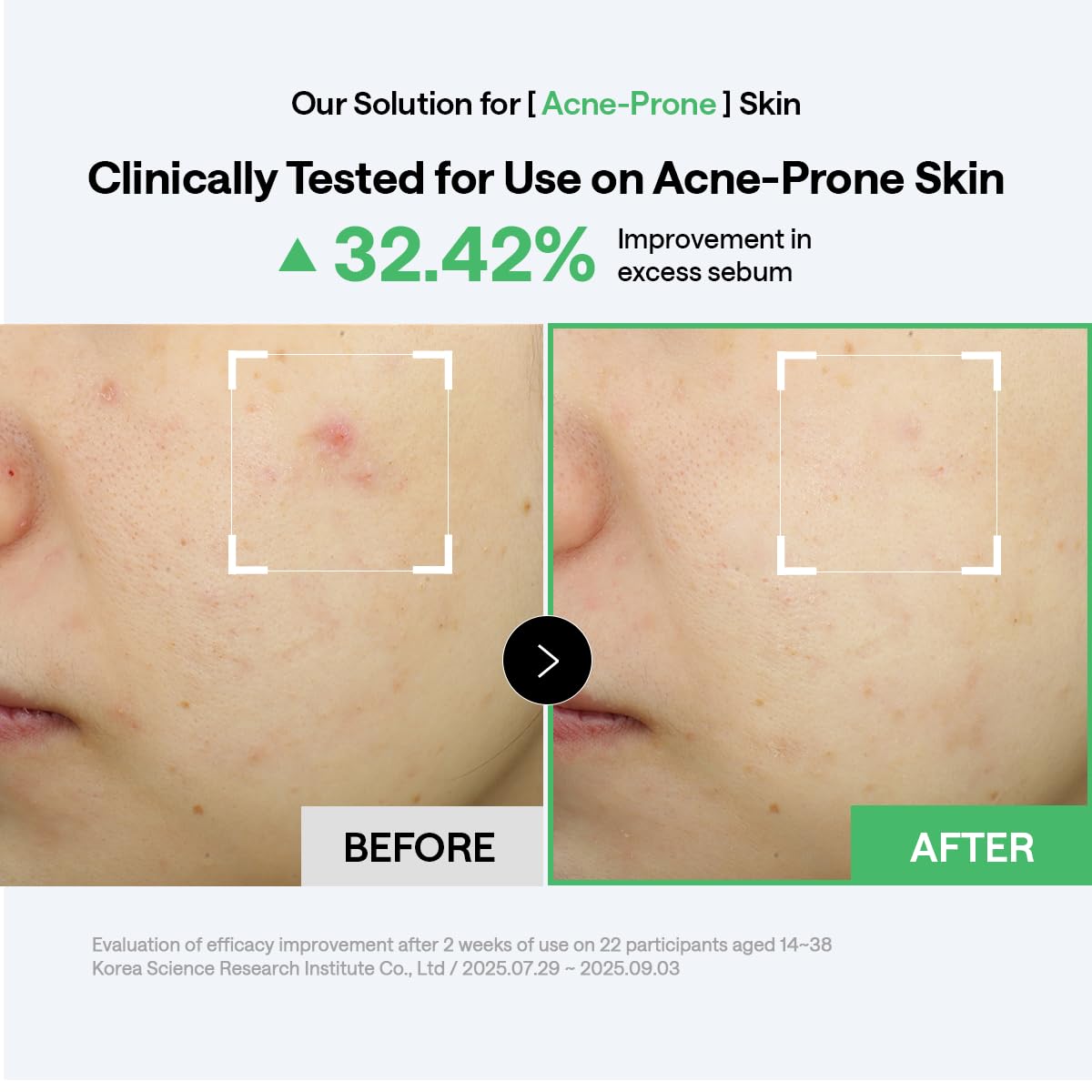 Mediheal Toner Pads